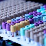 Workplace drug testing under AS/NZS 4308:2023 compliance standard in Australia