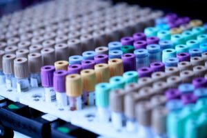 Workplace drug testing under AS/NZS 4308:2023 compliance standard in Australia